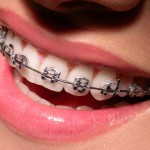 Surprising Causes Of Bad Breath